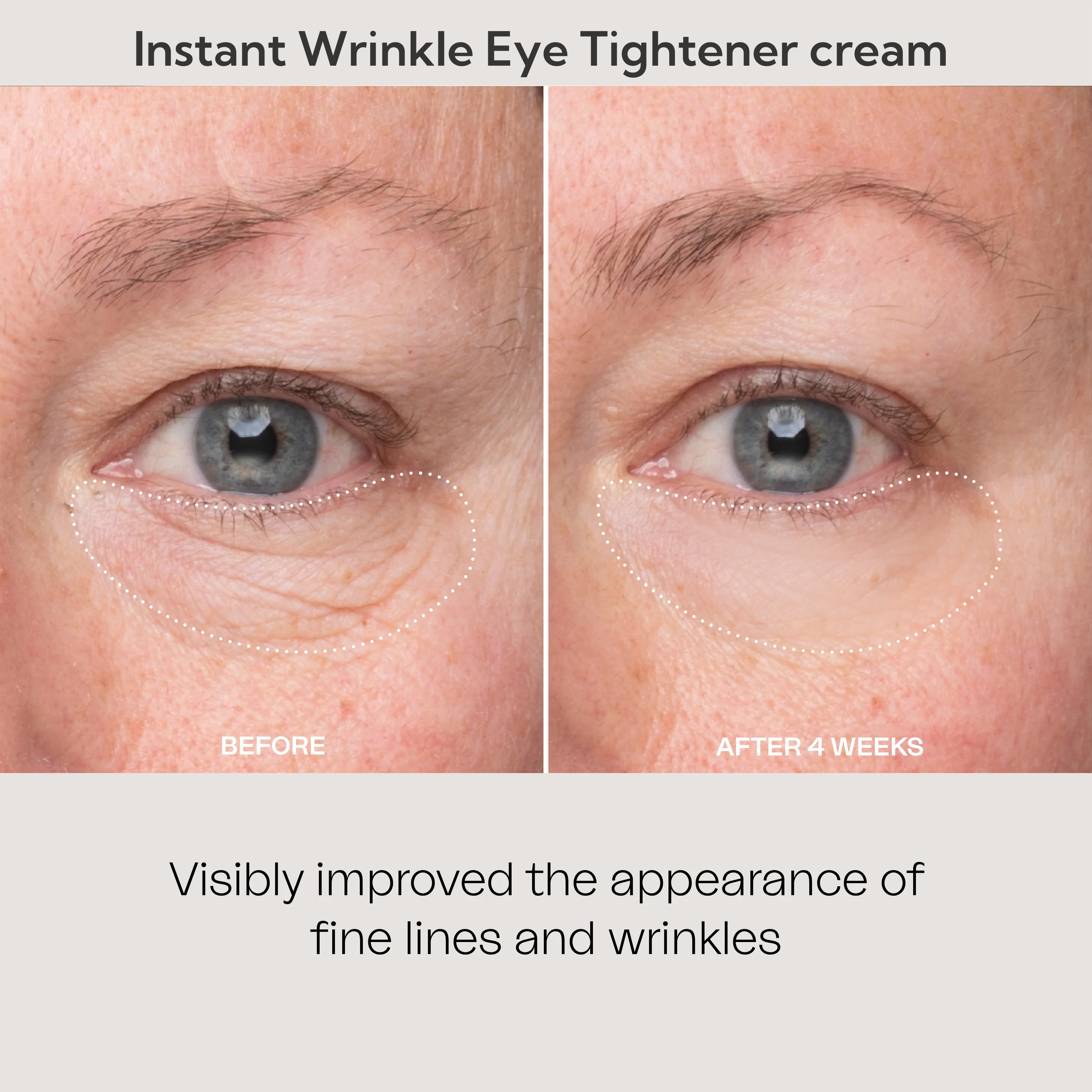 ⏰Last Day Sale 50% OFF🔥Instant Wrinkle Eye Tightener cream