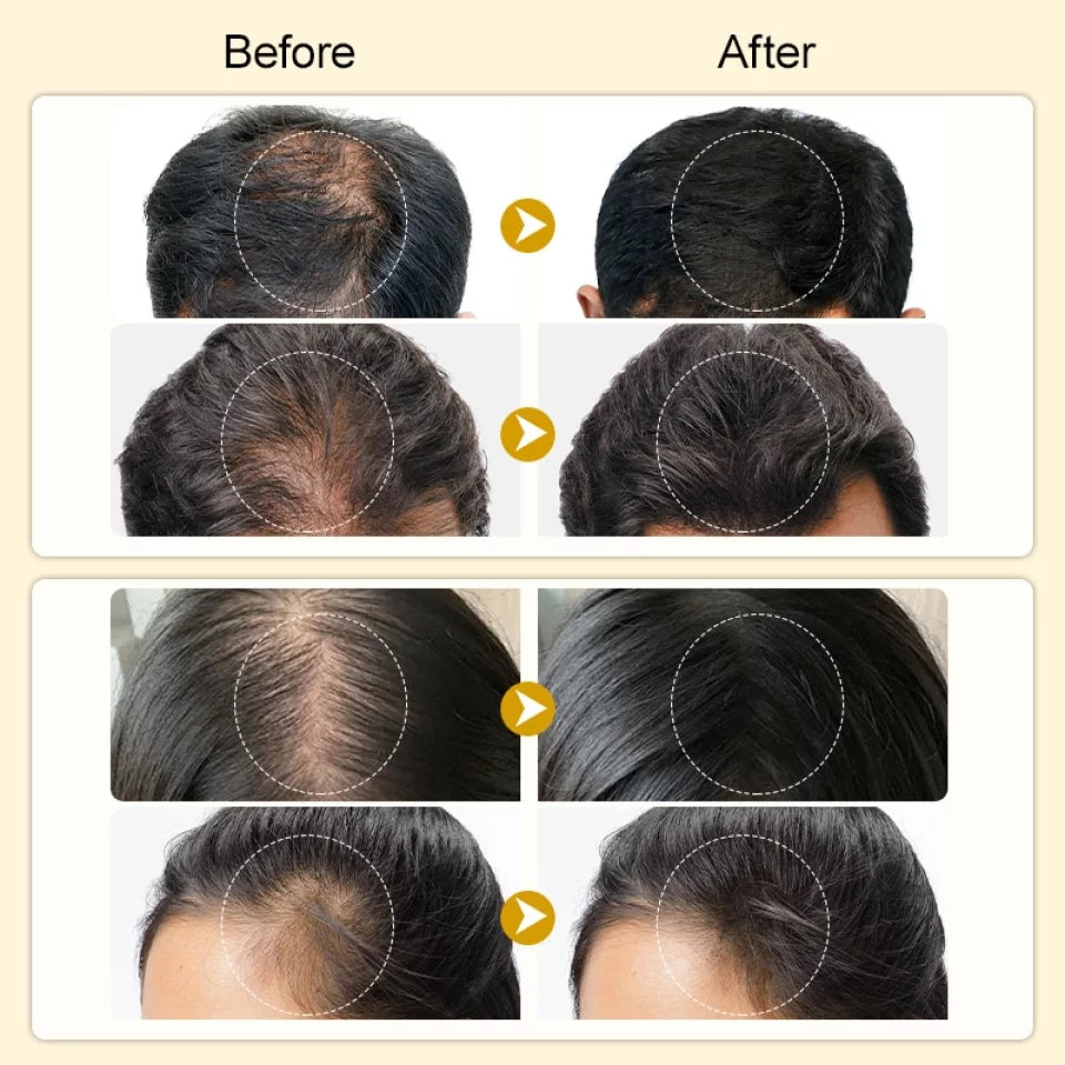 PURC Scalp Therapy – Boost Hair Growth & Stop Hair Loss!