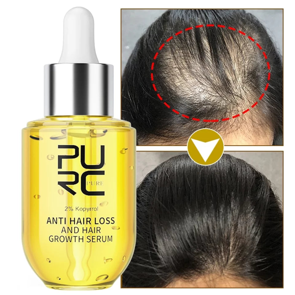 PURC Scalp Therapy – Boost Hair Growth & Stop Hair Loss!