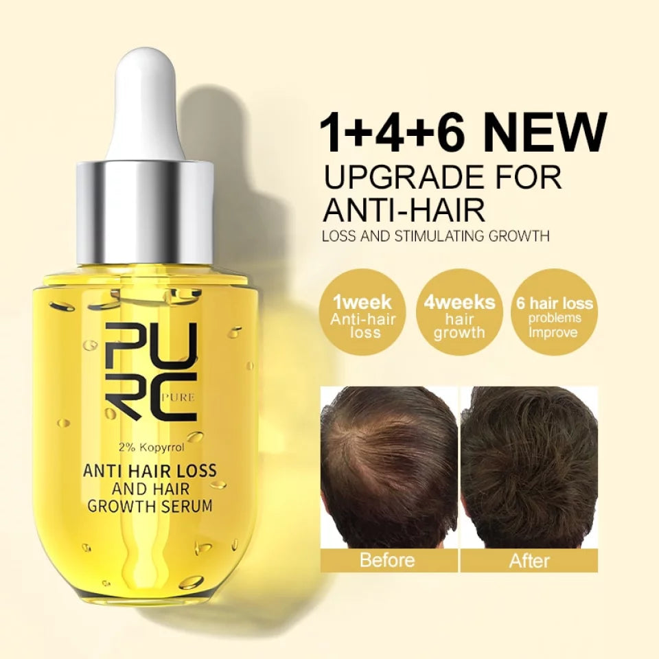 PURC Scalp Therapy – Boost Hair Growth & Stop Hair Loss!