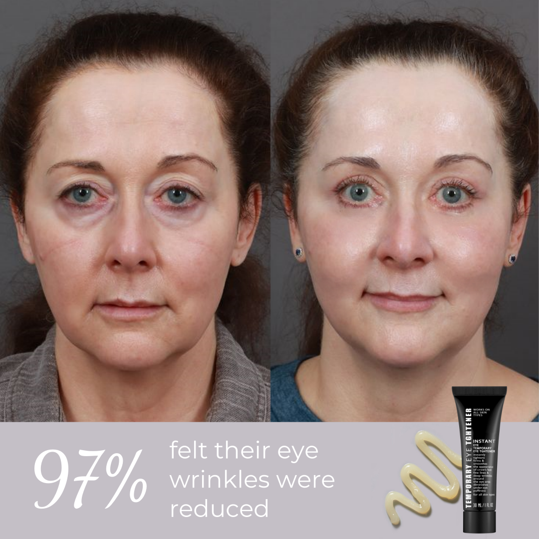 ⏰Last Day Sale 50% OFF🔥Instant Wrinkle Eye Tightener cream