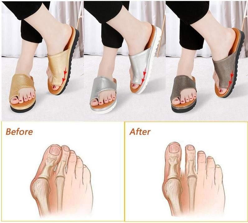 Bunion Corrector Sandals for Women